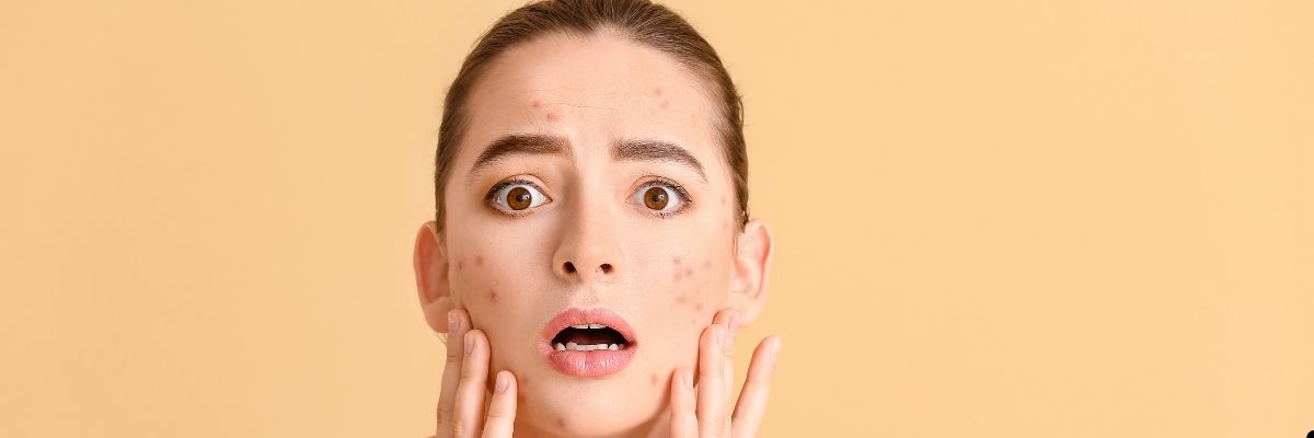 Cilt Stresi Nedir Belirtileri ve Baş Etme Yolları