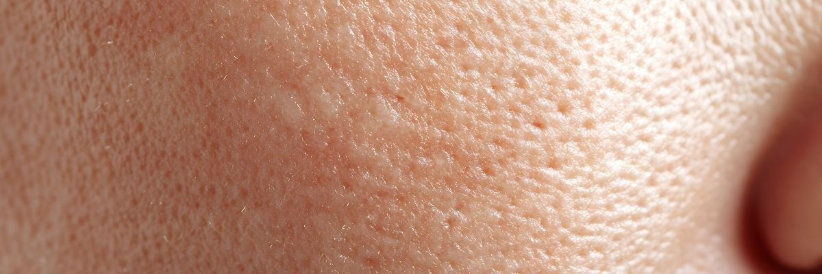 Gözenekleri Sıkılaştıran Doğal Yöntemler ve Ürünler